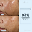 NuFACE Super Vita-C Booster Serum