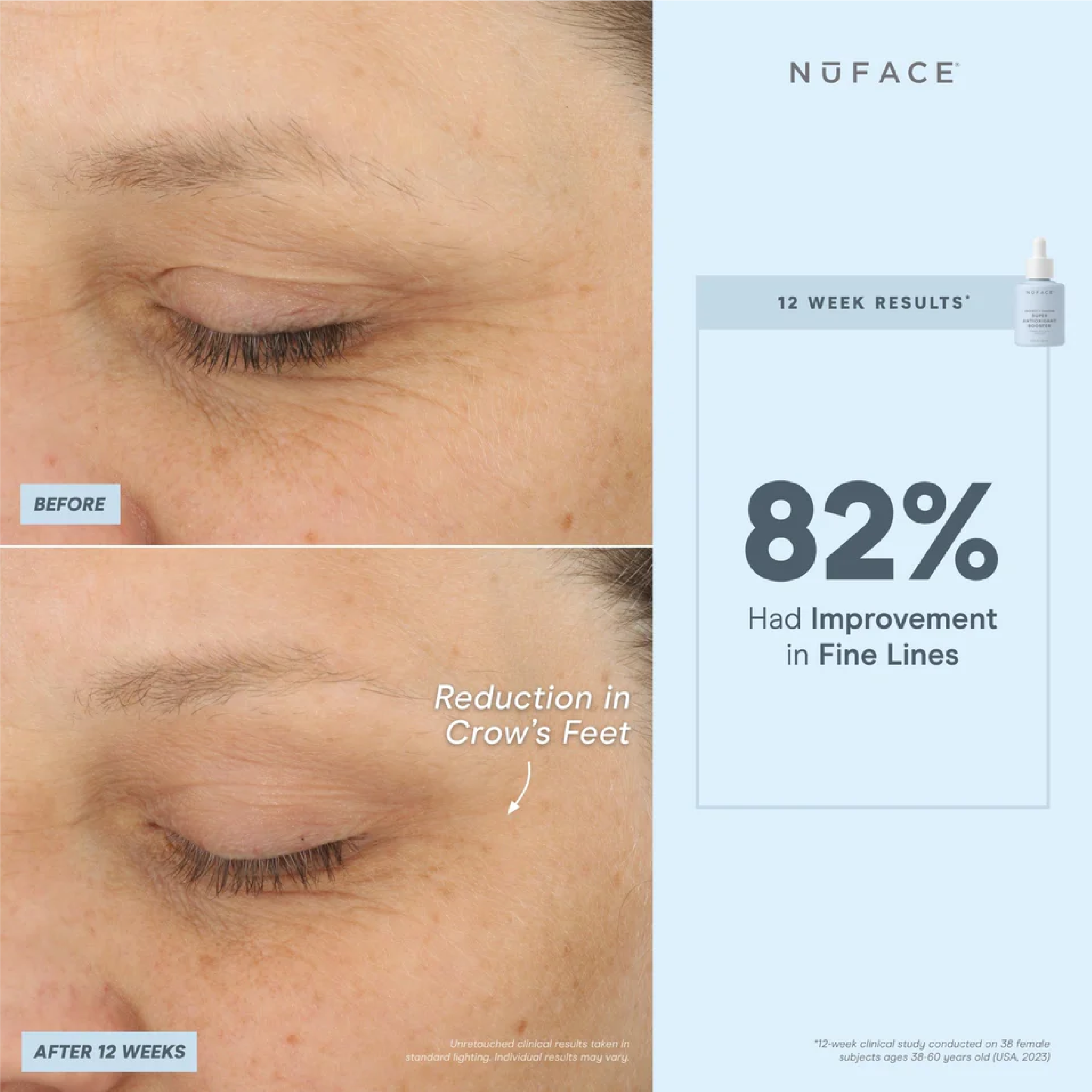 NuFACE Super Antioxidant Booster Serum