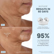 NuFACE Trinity+ Pro Smart Advanced Facial Toning Kit