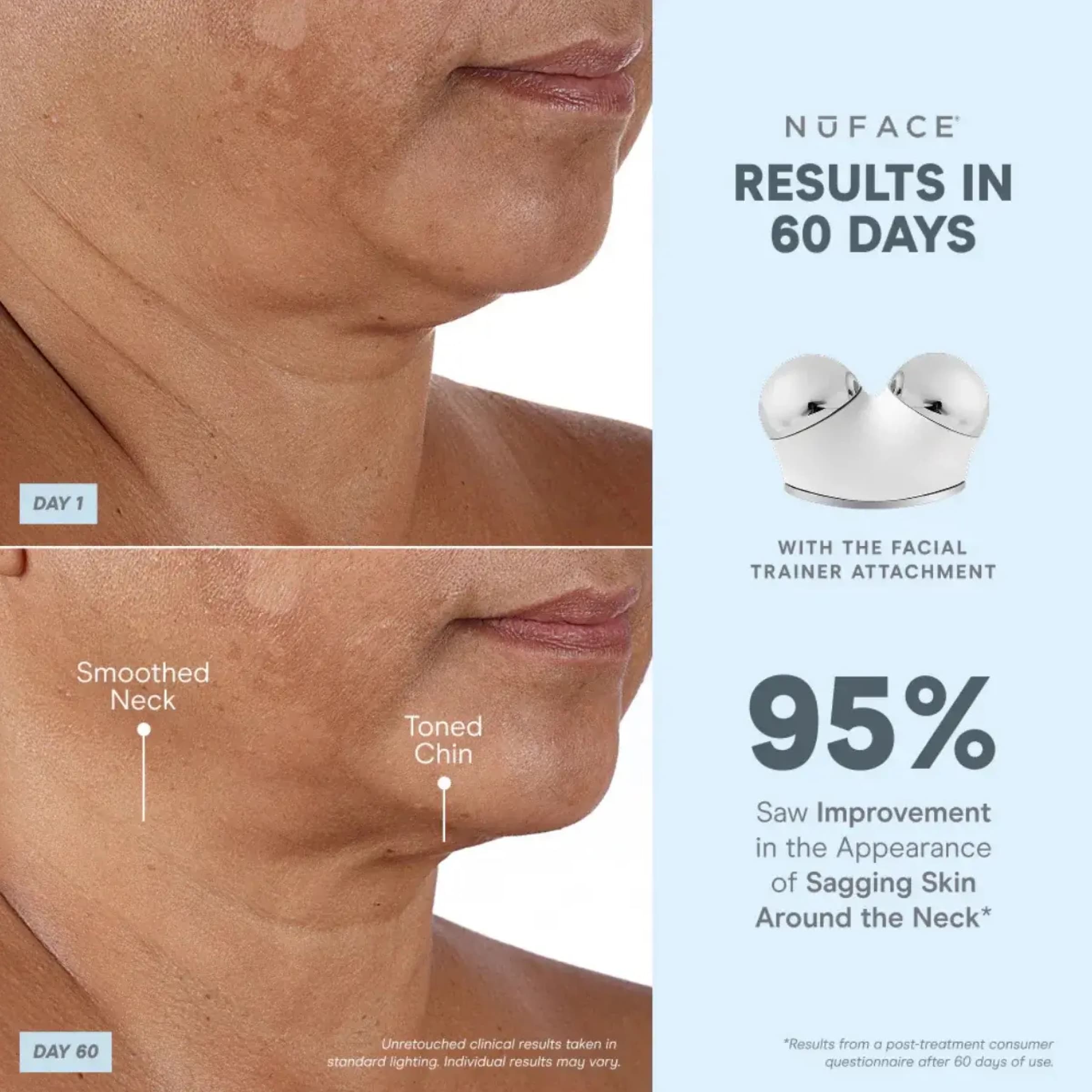 NuFACE Trinity+ Pro Smart Advanced Facial Toning Kit