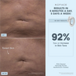NuFACE NuBODY Body Toning Device