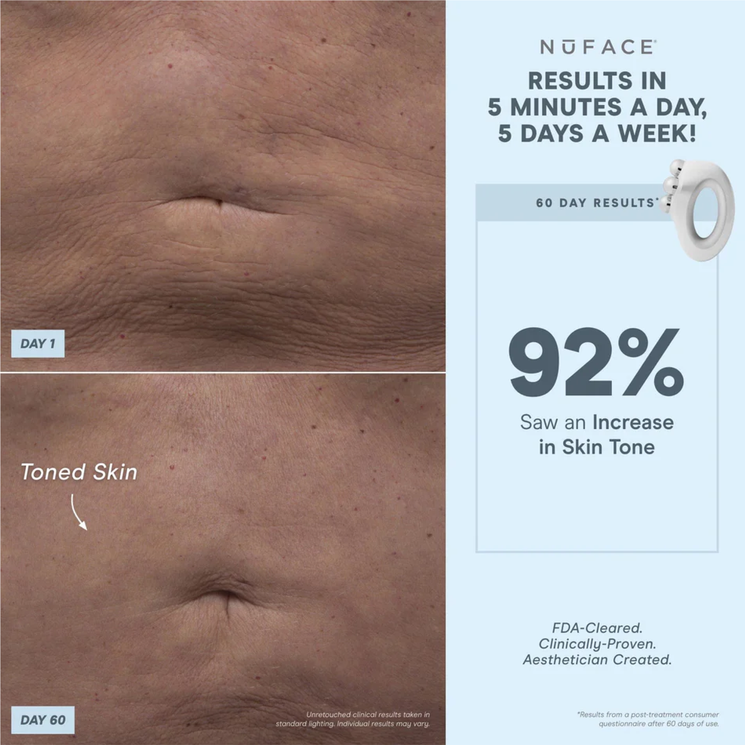 NuFACE NuBODY Body Toning Device