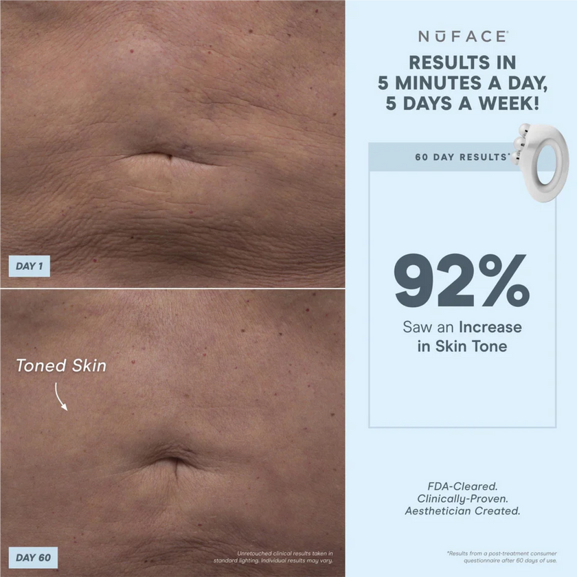 NuFACE NuBODY Body Toning Device
