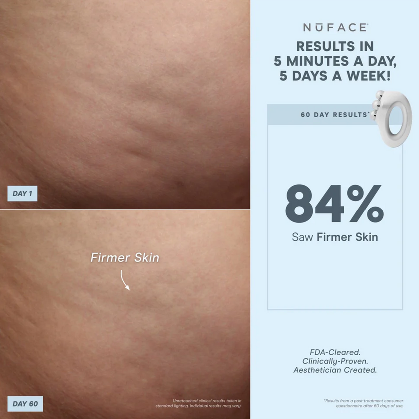 NuFACE NuBODY Body Toning Device