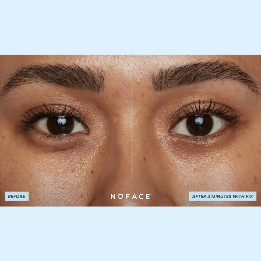 NuFACE IonPlex® Hydra-Gel Power Patches