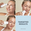 NuFACE Trinity+ Pro ELE Attachment