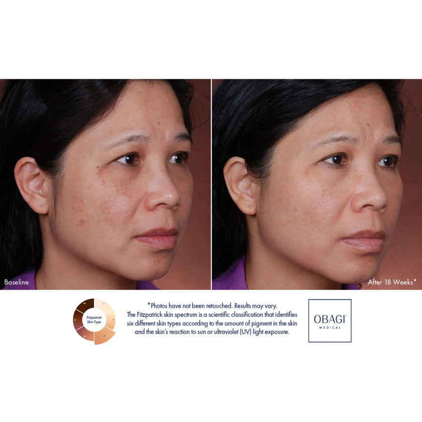 Obagi Nu-Derm® Blend Fx