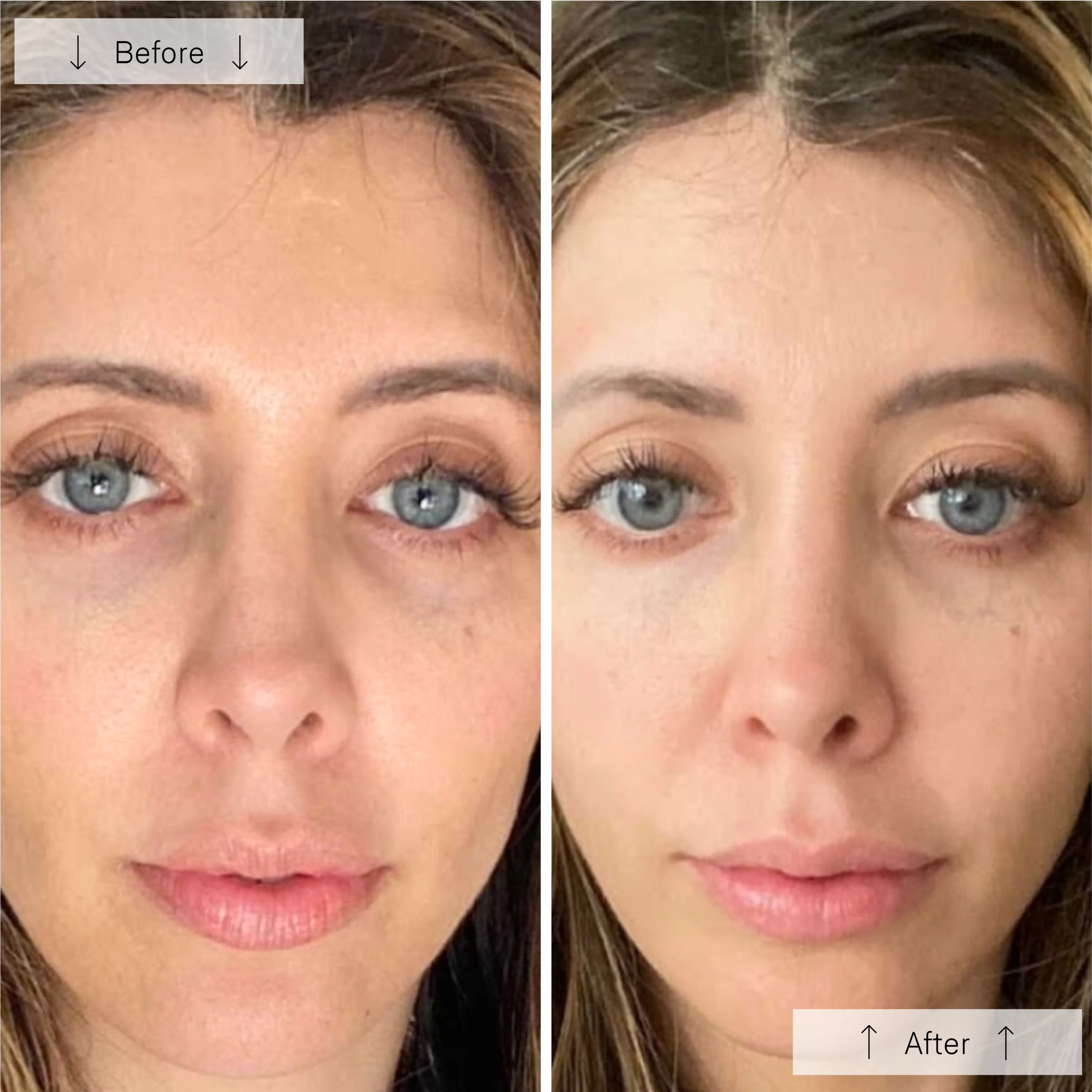 Omnilux Contour LED Face Mask