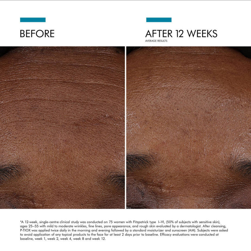 SkinCeuticals P-TIOX