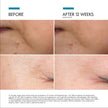SkinCeuticals P-TIOX