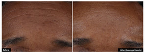 SkinCeuticals P-TIOX