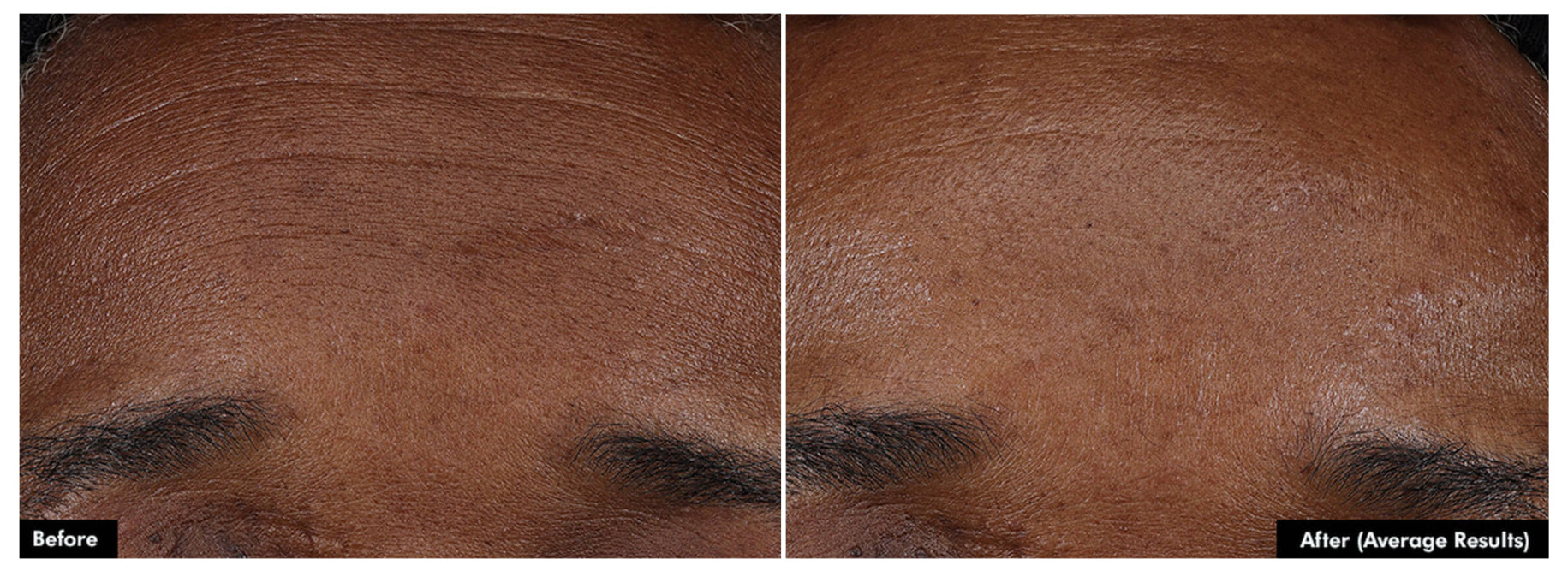 SkinCeuticals P-TIOX