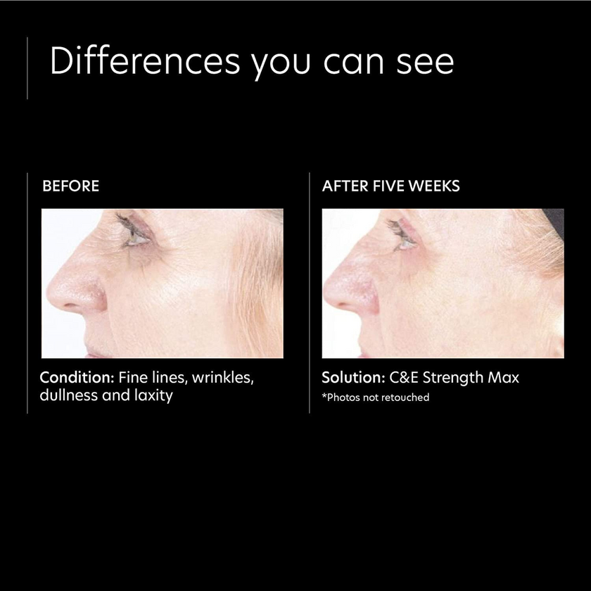 PCA Skin C&E Strength Max