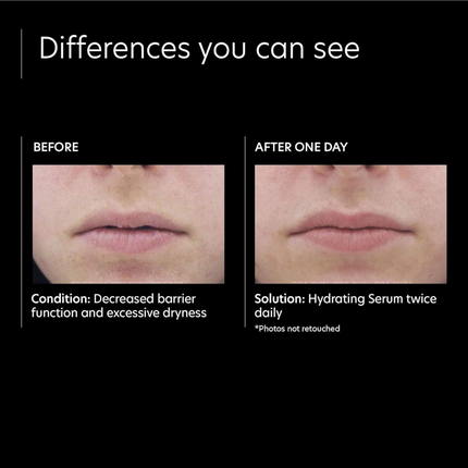 PCA Skin Hydrating Serum