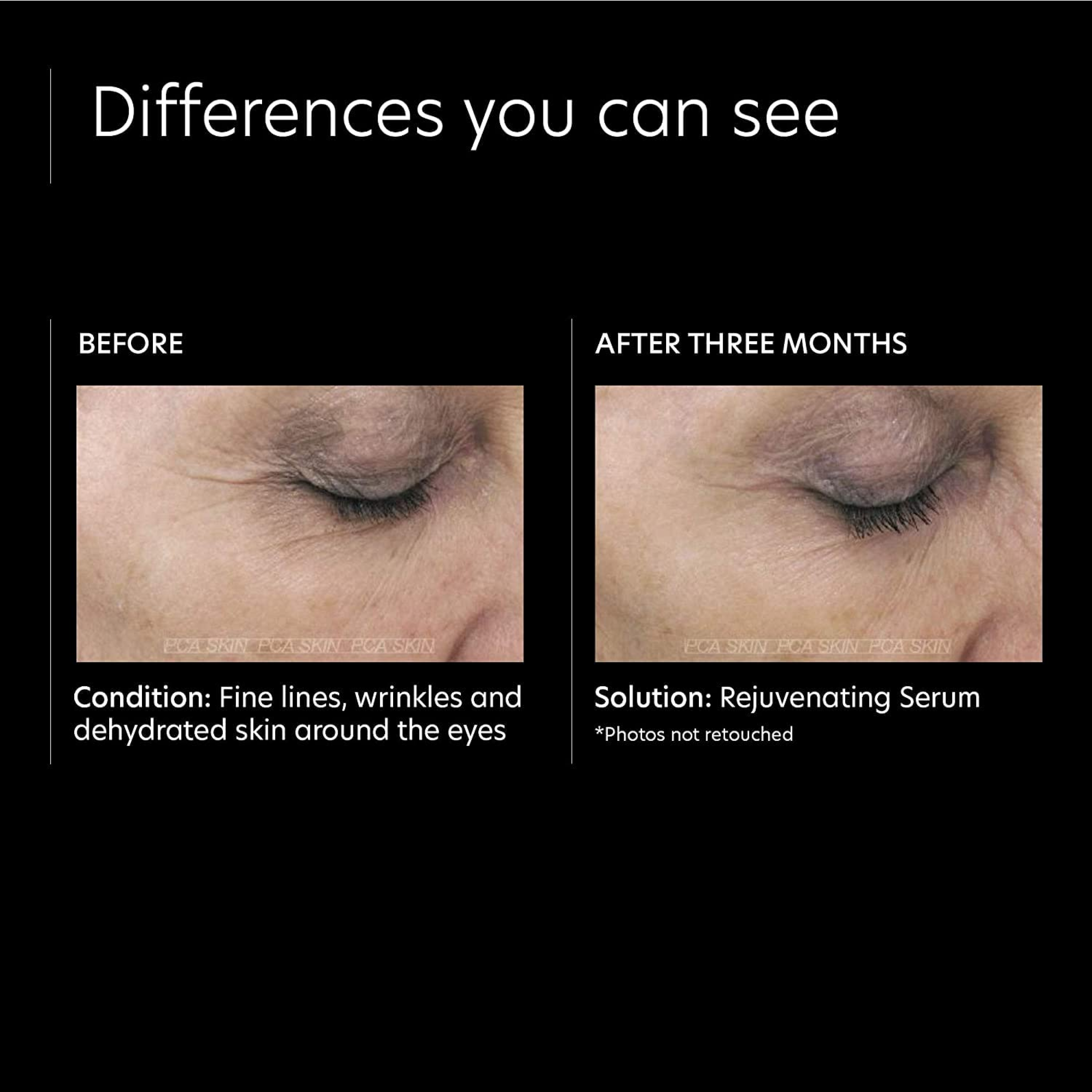 PCA Skin Rejuvenating Serum