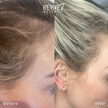 Revive7 Revitalizing Hair Treatment (30ml)