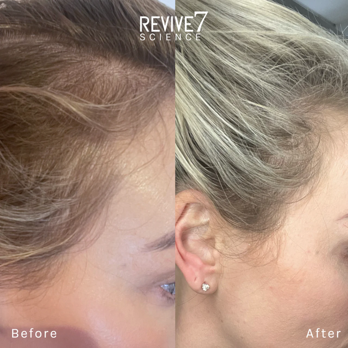 Revive7 Revitalizing Hair Treatment (30ml)