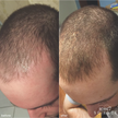 Revive7 Revitalizing Hair Treatment (30ml)