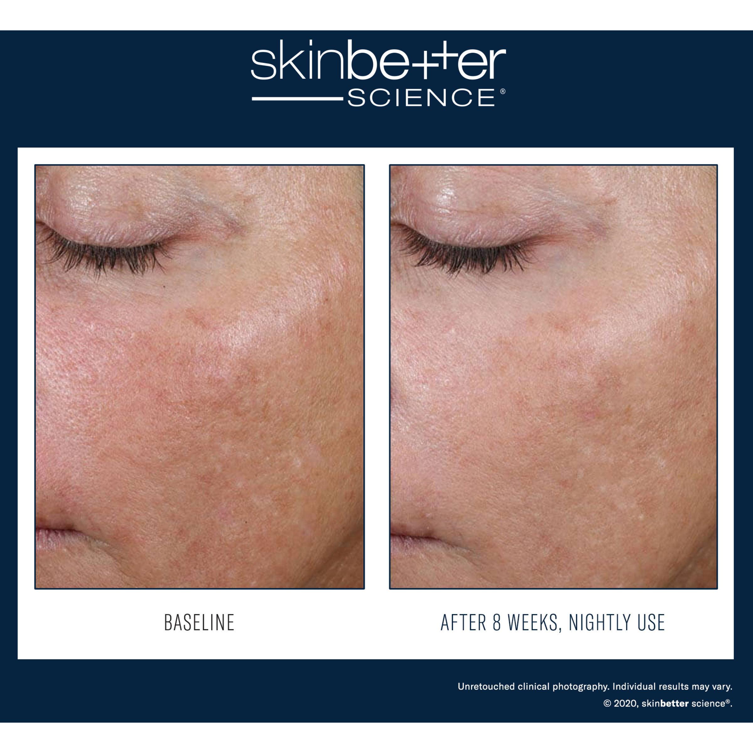 SkinBetter Alto Advanced Defense and Repair Serum