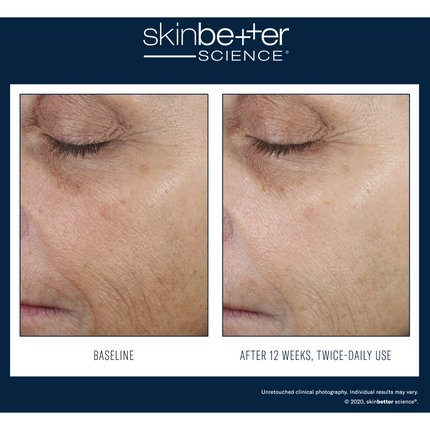 SkinBetter Even Tone Correcting Serum