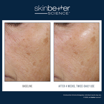 SkinBetter Trio Rebalancing Moisture Treatment