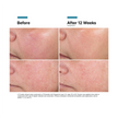 SkinCeuticals Advanced RGN-6