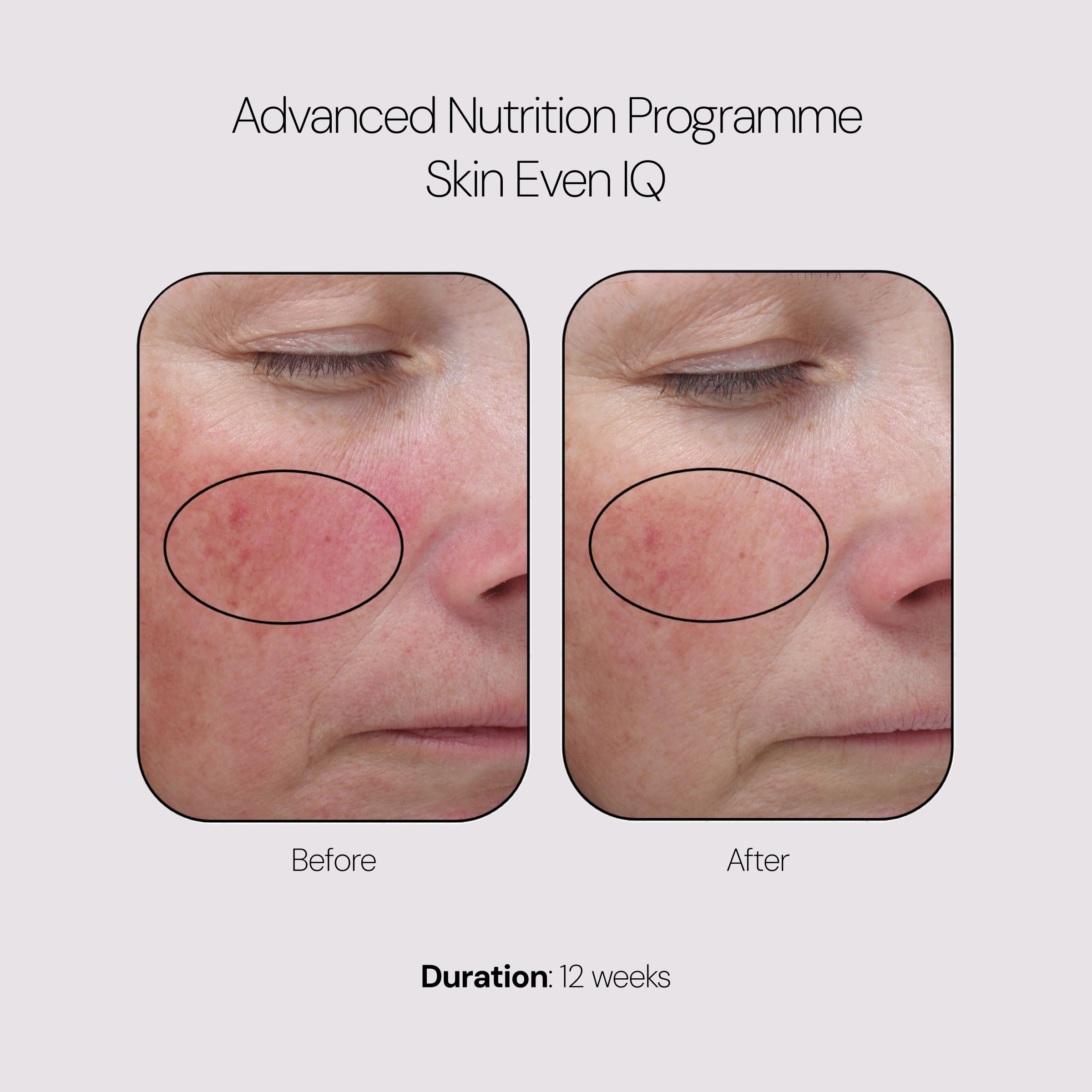 Advanced Nutrition Programme Skin Even IQ (28 Pods)
