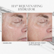 SkinMedica HA5® Rejuvenating Hydrator