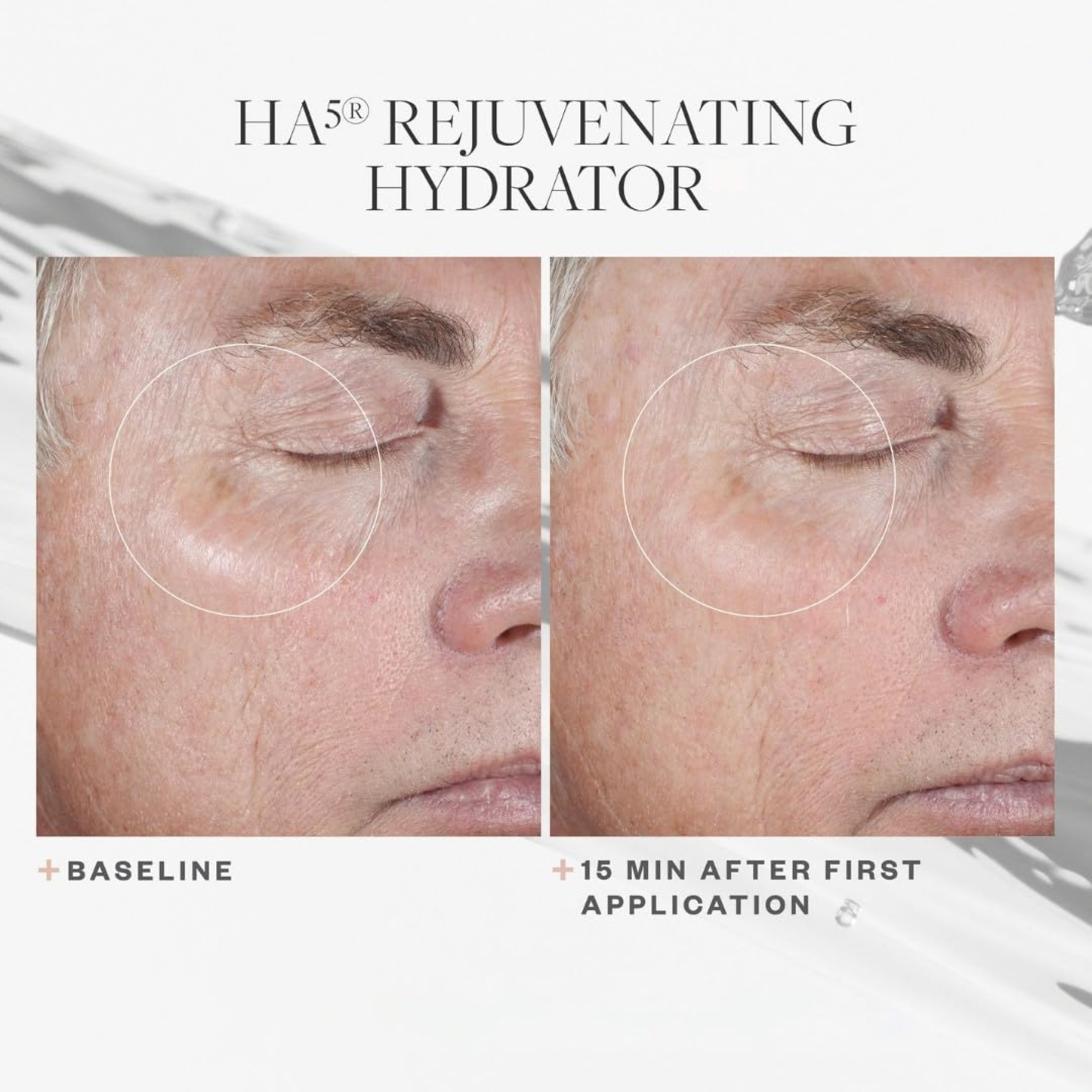 SkinMedica HA5® Rejuvenating Hydrator