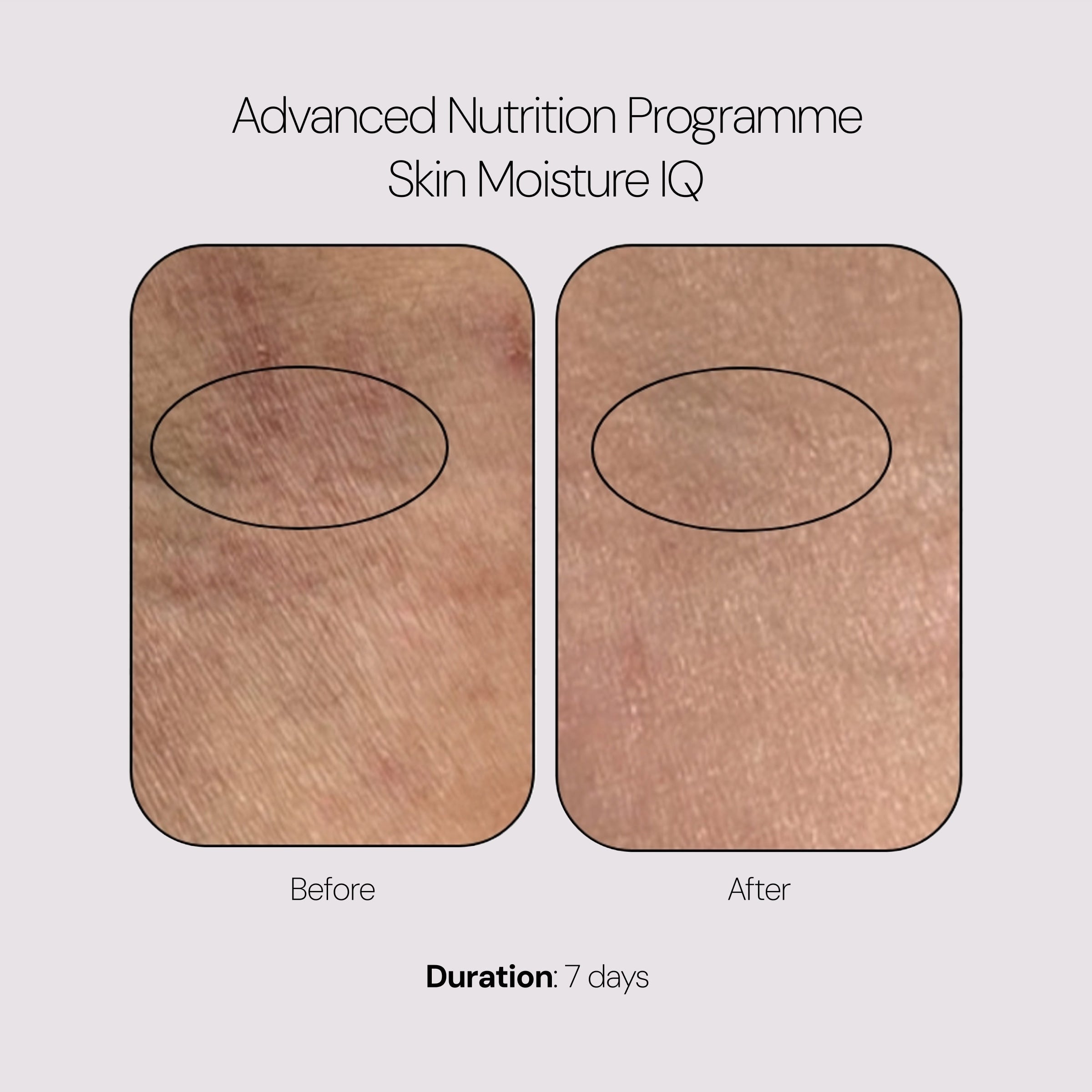Advanced Nutrition Programme Skin Moisture IQ (28 Pods)