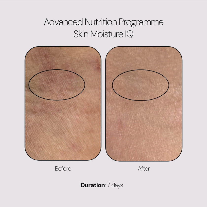 Advanced Nutrition Programme Skin Moisture IQ (28 Pods)