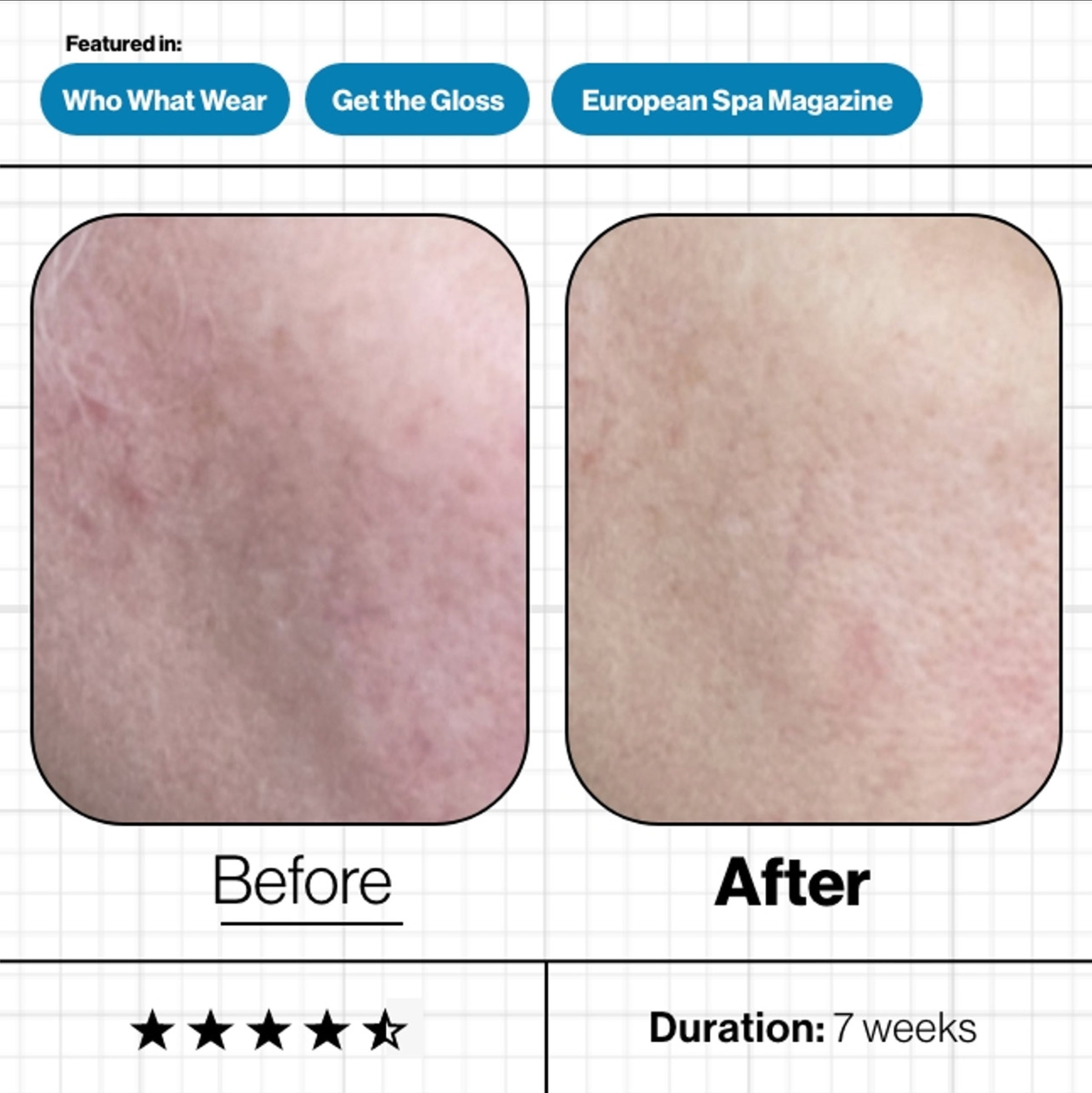 Advanced Nutrition Programme Skin Moisture IQ (28 Pods)