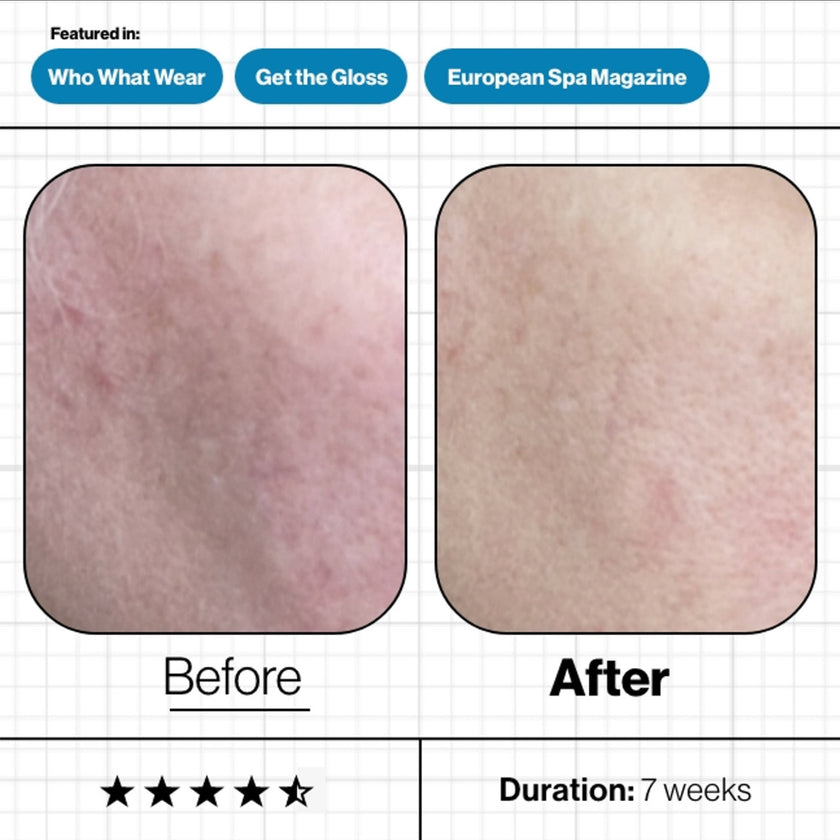 Advanced Nutrition Programme Skin Moisture IQ (28 Pods)