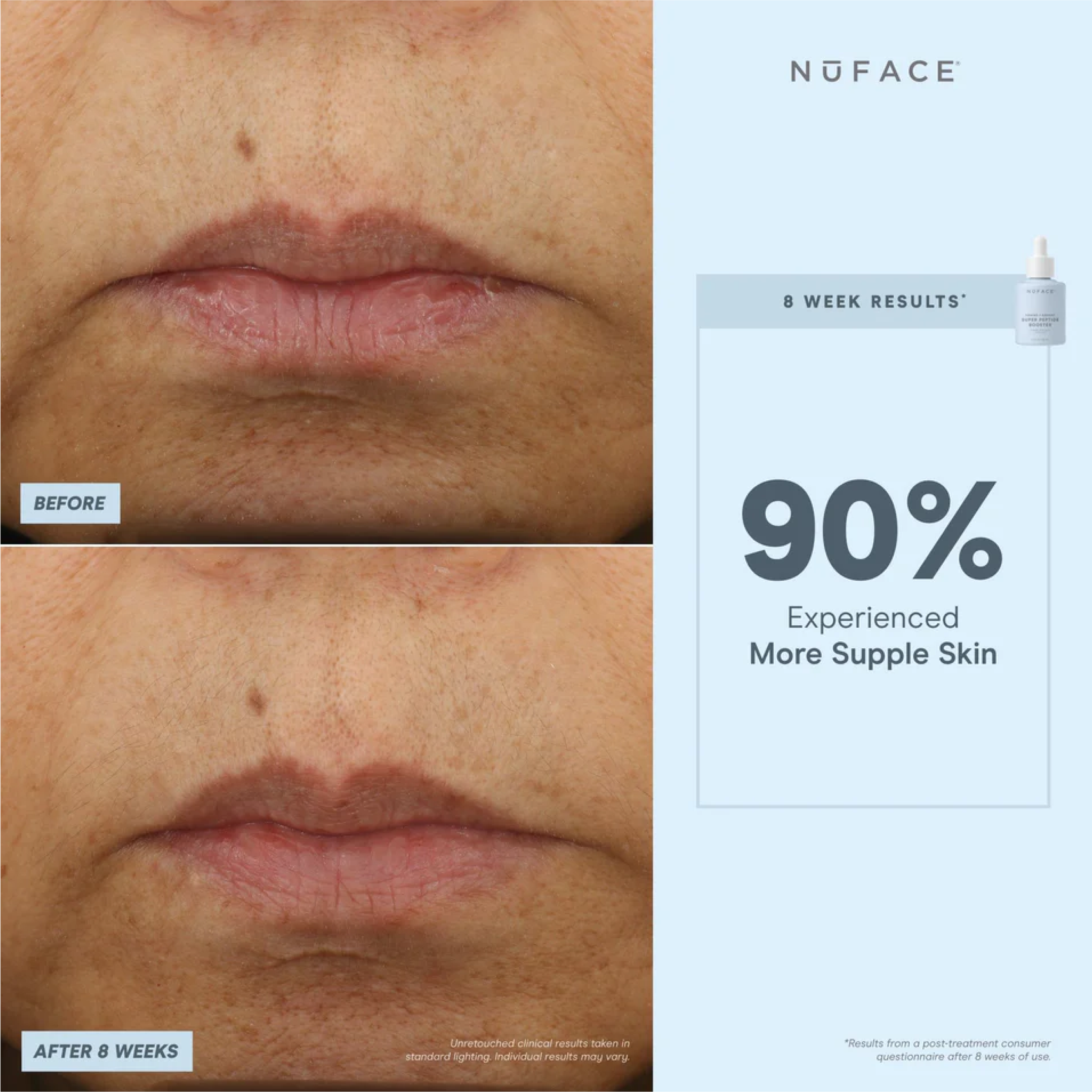 NuFACE Super Peptide Booster Serum