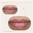 Teoxane [3D] Lip, Nourishing & Plumping Lip Care