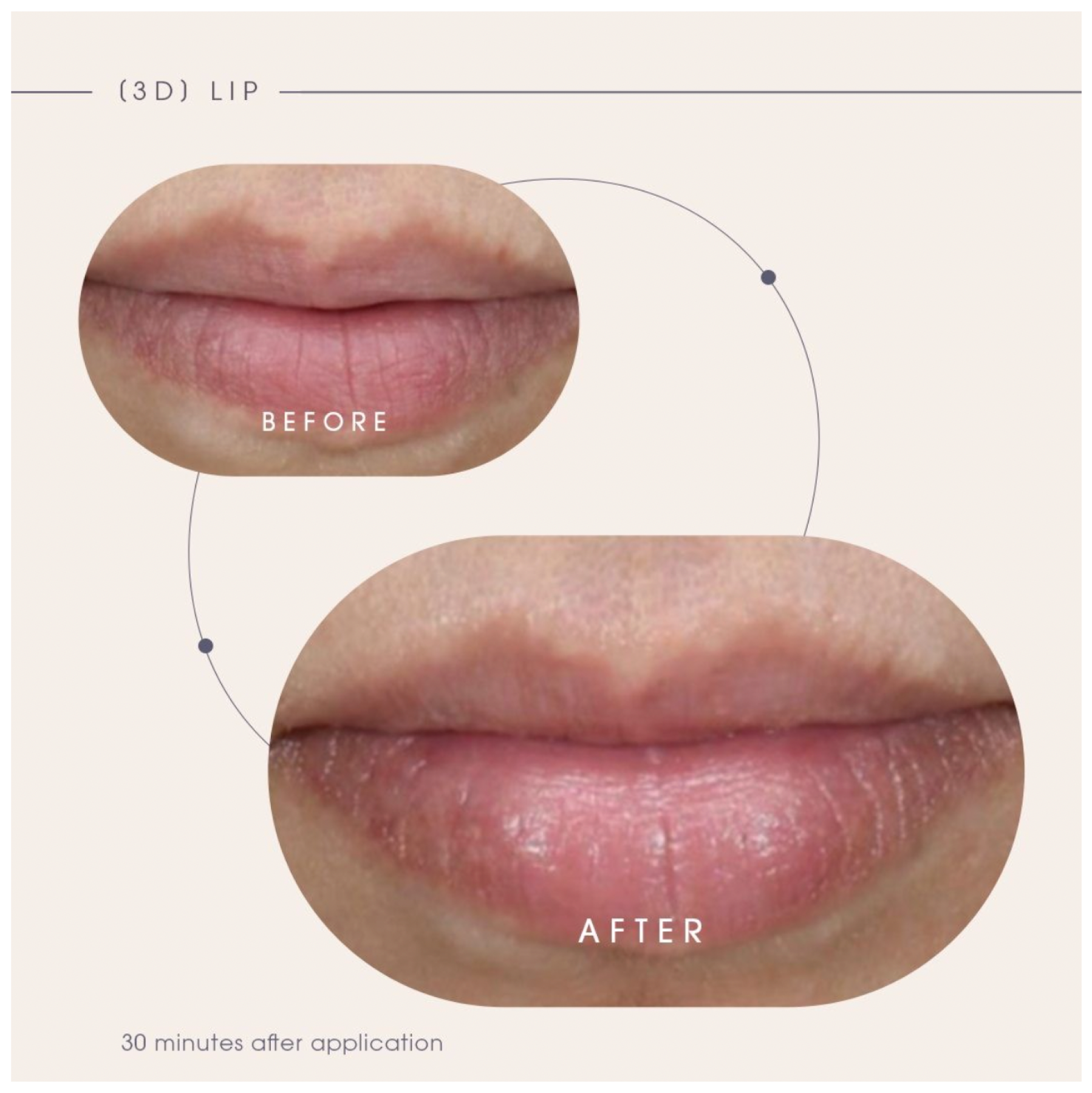 Teoxane [3D] Lip, Nourishing & Plumping Lip Care