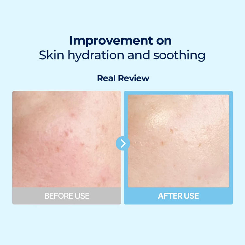 Torriden Dive-In Low Molecular Hyaluronic Acid Mask Pack