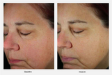 ZO Skin Health Next-Generation Daily Power Defense