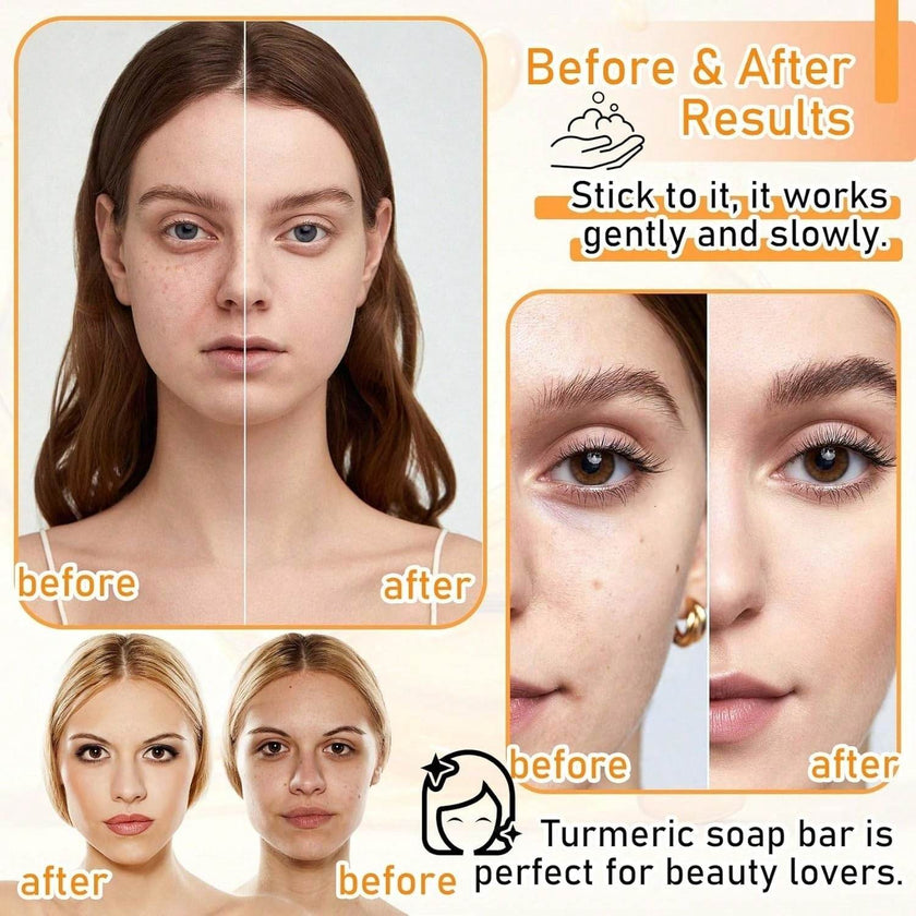 Body Face Brightening Turmeric Hyperpigmentation Bar Soap
