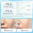 Aloe Pore Clear Solid Mask Cleaning