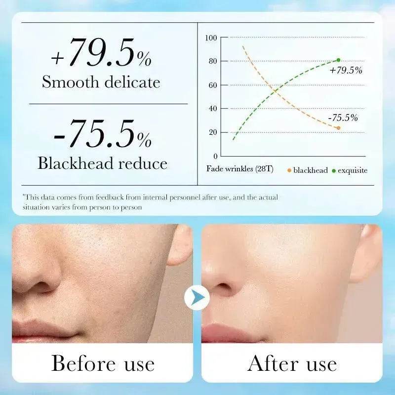 Aloe Pore Clear Solid Mask Cleaning