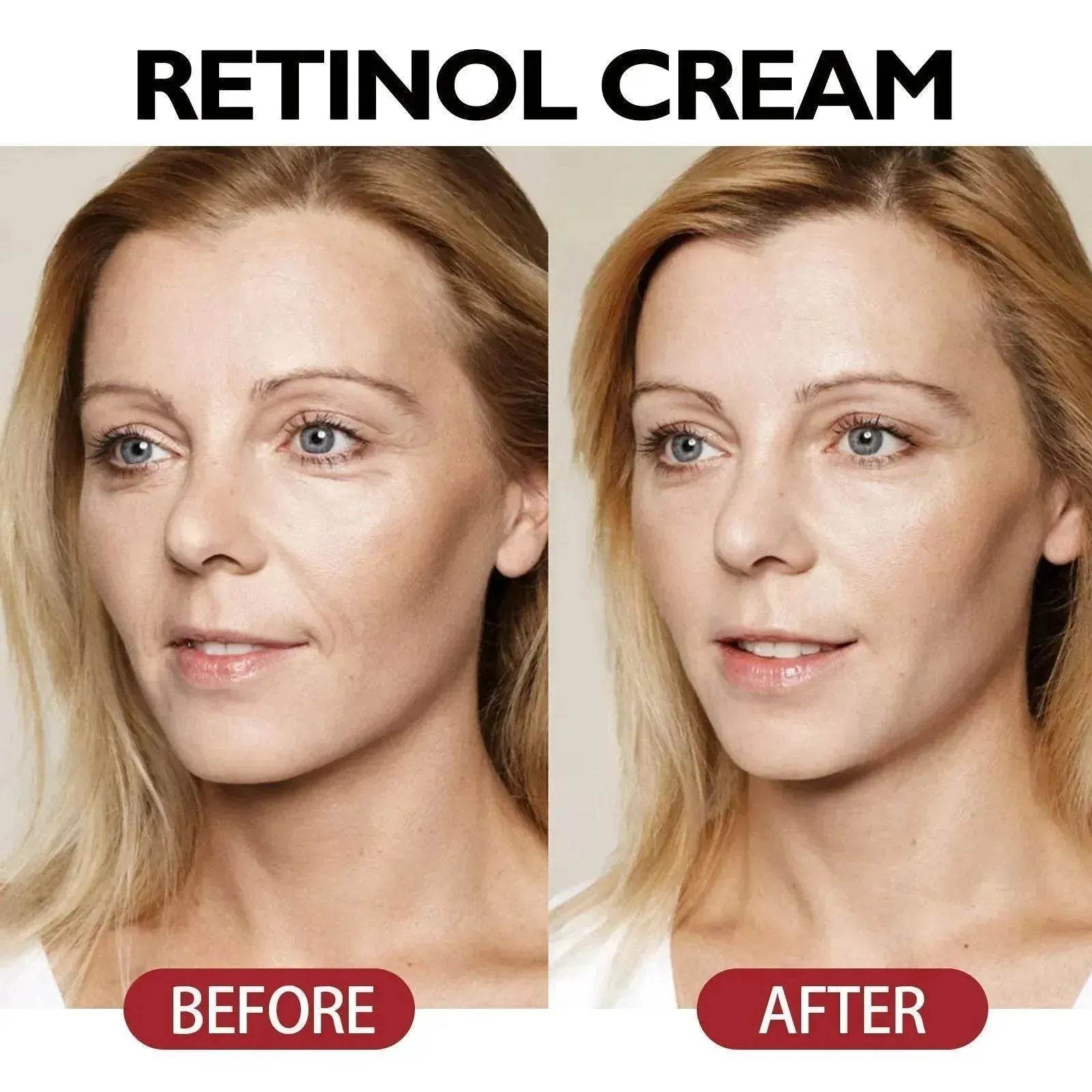 Anti-Aging Nourishing And Firming Skin Anti-wrinkle Face Cream