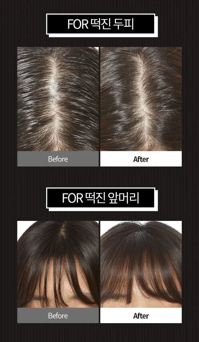 APIEU Oily Hair Dry Powder 5g