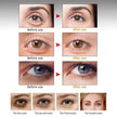 ARTISCARE Anti Wrinkle Eye cream Dark Circle Remover