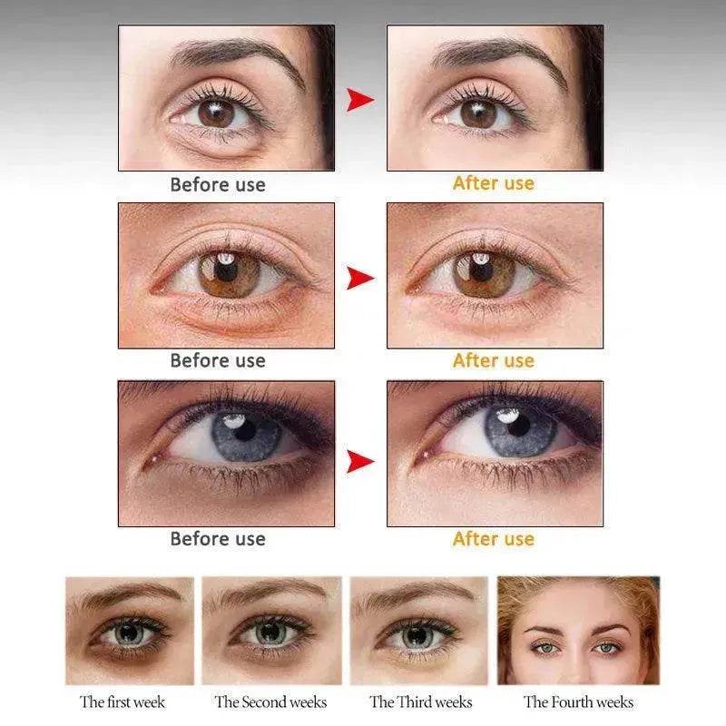 ARTISCARE Anti Wrinkle Eye cream Dark Circle Remover
