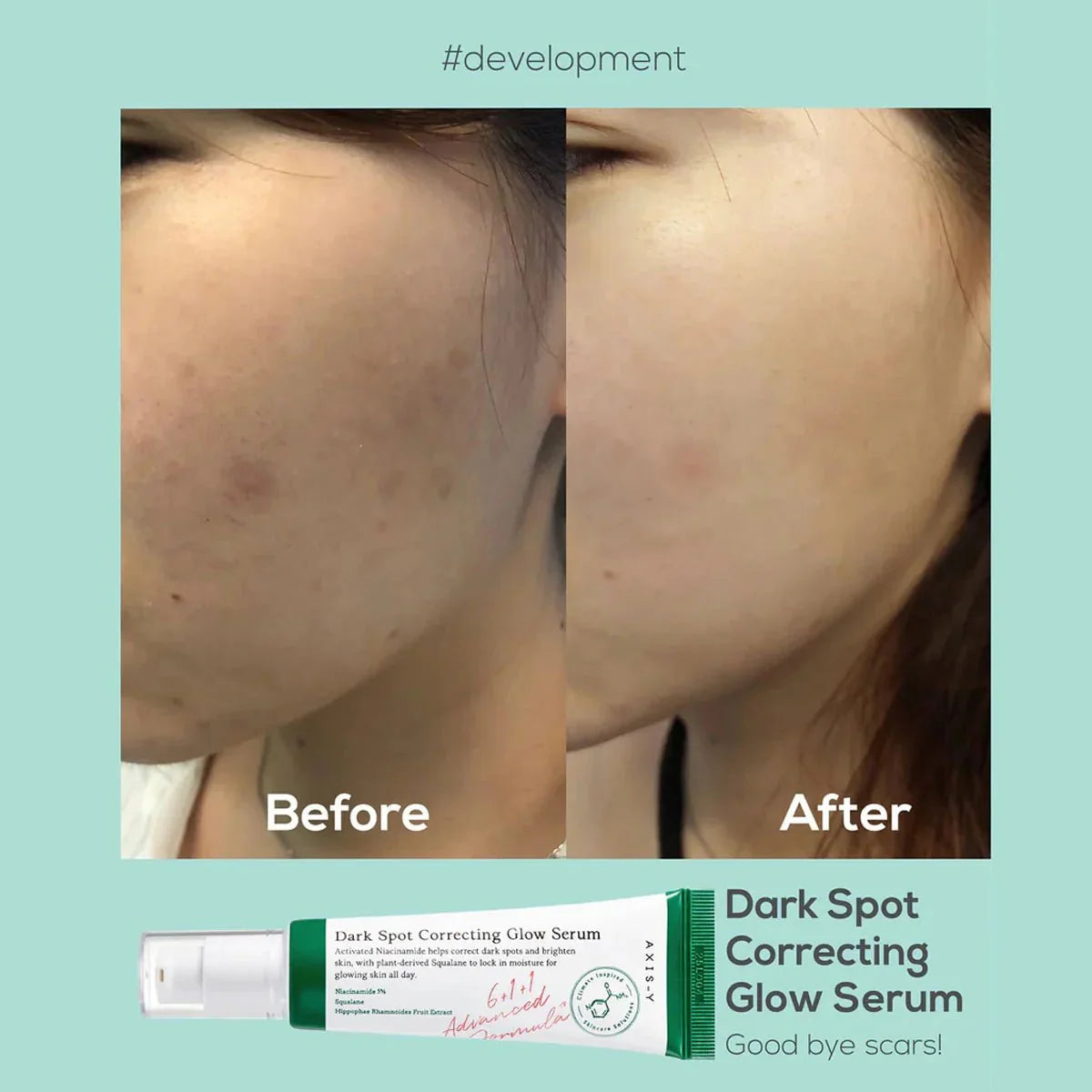 Axis-y Dark Spot Glow Serum 50ml