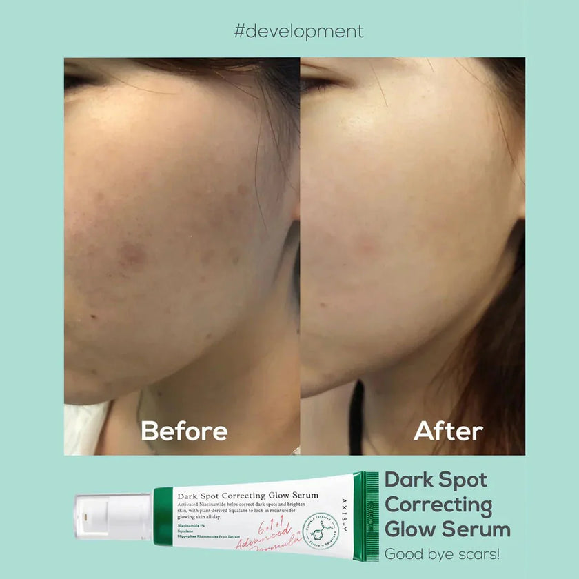Axis-y Dark Spot Glow Serum 50ml