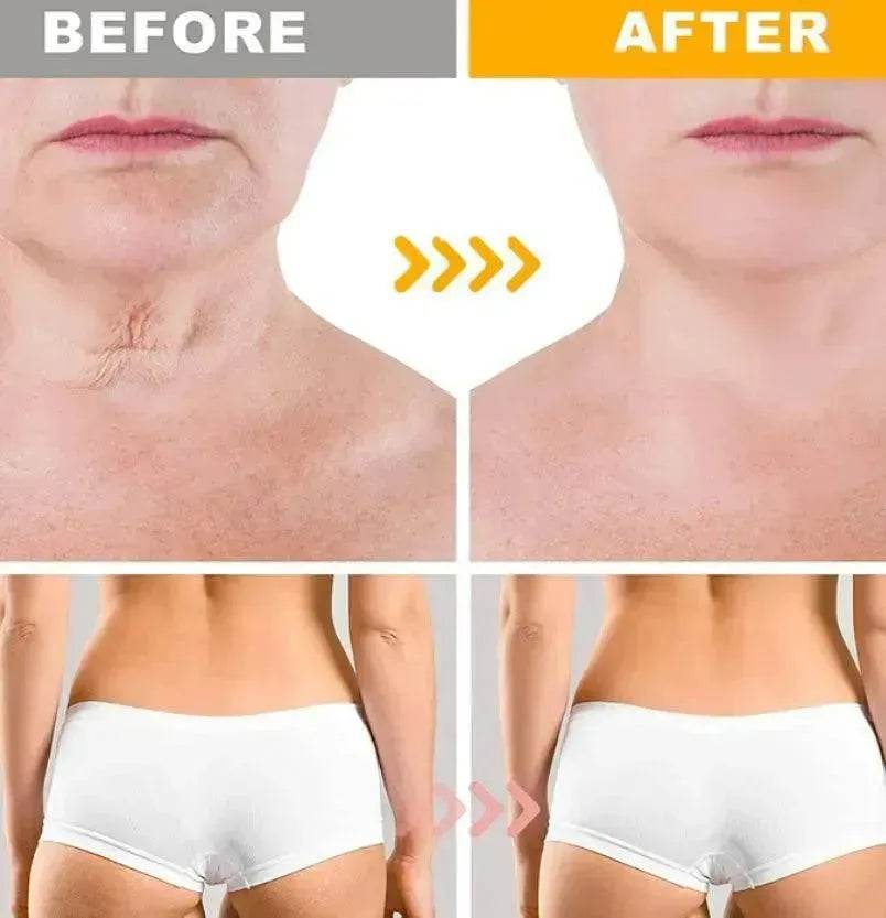 Crazylife Bee Venom Dual-purpose Body Face Repair Cream