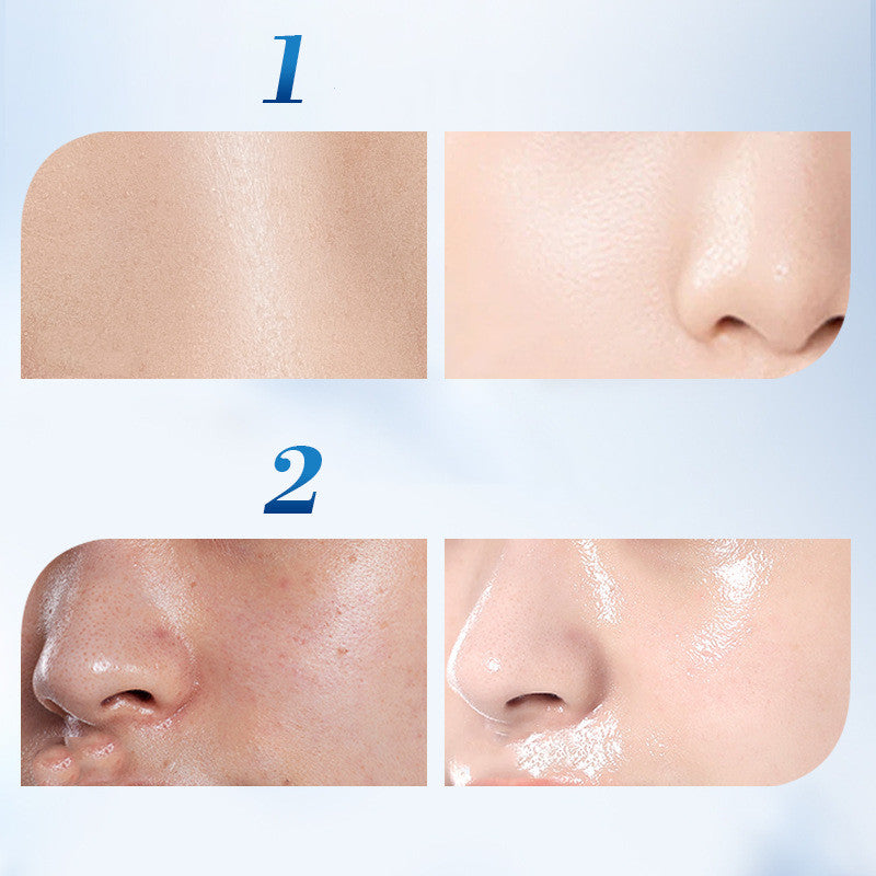 Nicotinamide Whitening Facial Essence 30ml – Brightening & Freckle Removing Serum