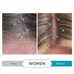 Dandrene Anti-Dandruff Conditioner